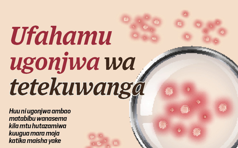 SHINA LA UHAI: Ufahamu ugonjwa wa Tetekuwanga na matibabu yake