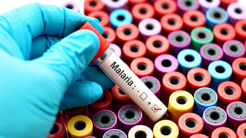 TAHARIRI: Wadau waungane kumaliza athari za malaria nchini