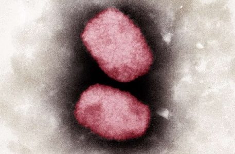 Sampuli za wanaohofiwa kuugua ‘monkeypox’ kupimwa nchini Senegal