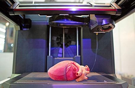 SHINA LA UHAI: Teknolojia ya ‘3D printing’ yaleta afueni kwa upasuaji